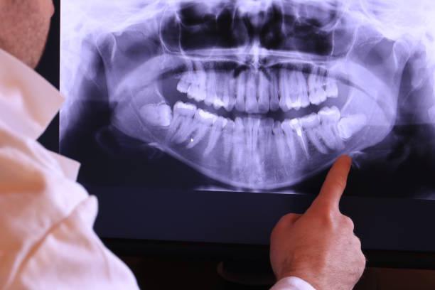 Best Emergency Treatment for Toothache in Wormleysburg, PA