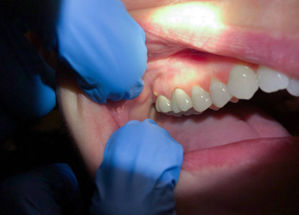 Best 24-Hour Emergency Dentist in Wormleysburg, PA